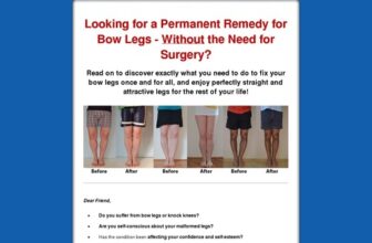 Bow Legs No More - How to Straighten Your Legs Without Surgery!