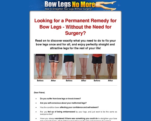 Bow Legs No More - How to Straighten Your Legs Without Surgery!