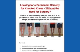 Knocked Knees No More - How to Straighten Your Legs Without Surgery!