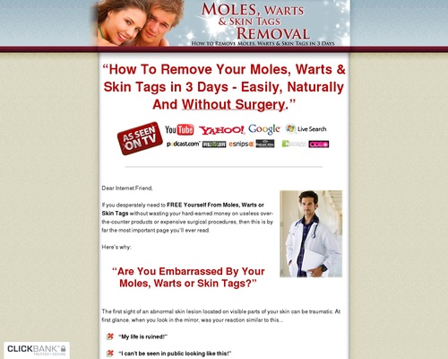 Moles, Warts & Skin Tags Removal - How To Safely & Permanently Remove Moles, Warts & Skin Tags